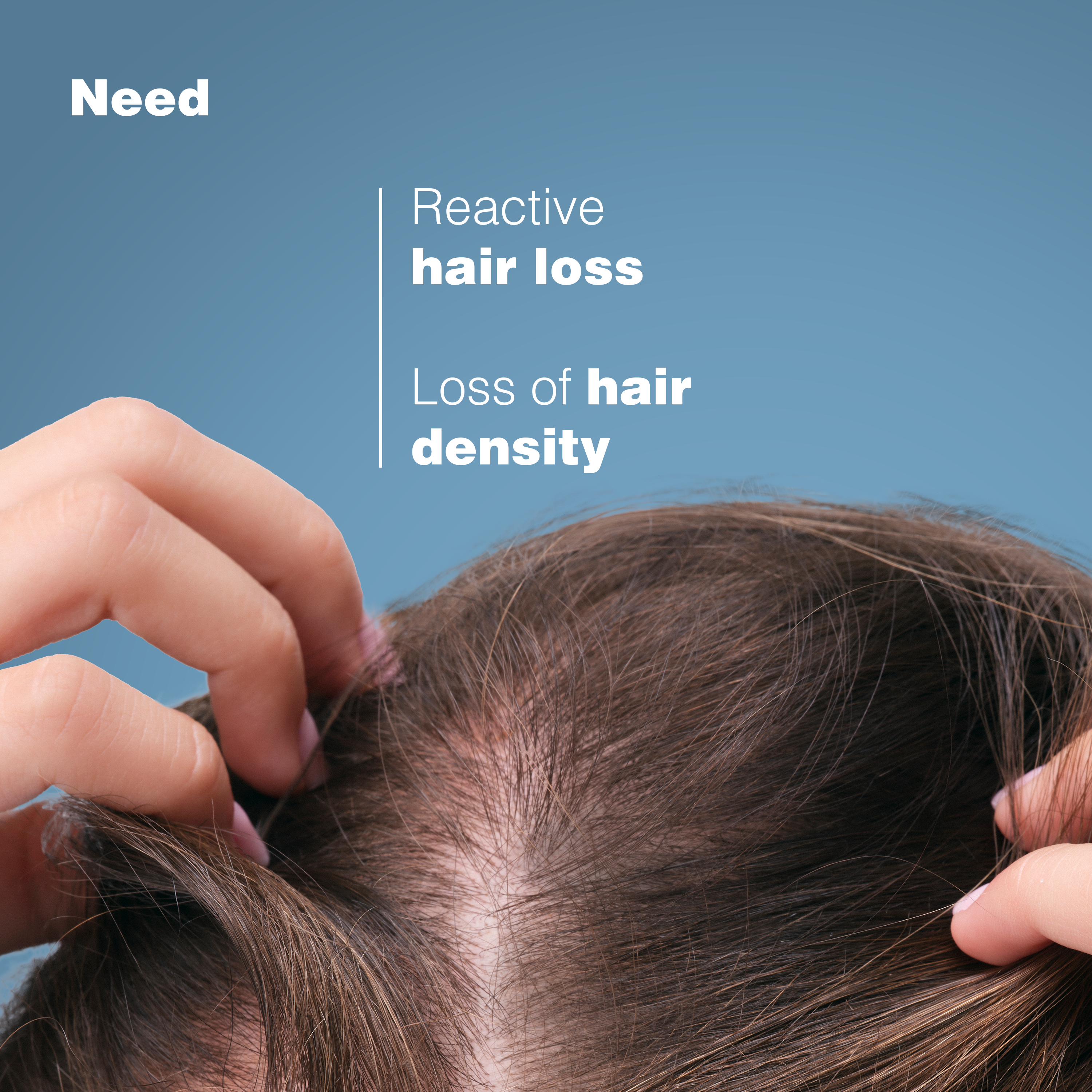 Anaphase Anti-Hair Loss Shampoo 400ML — image 5
