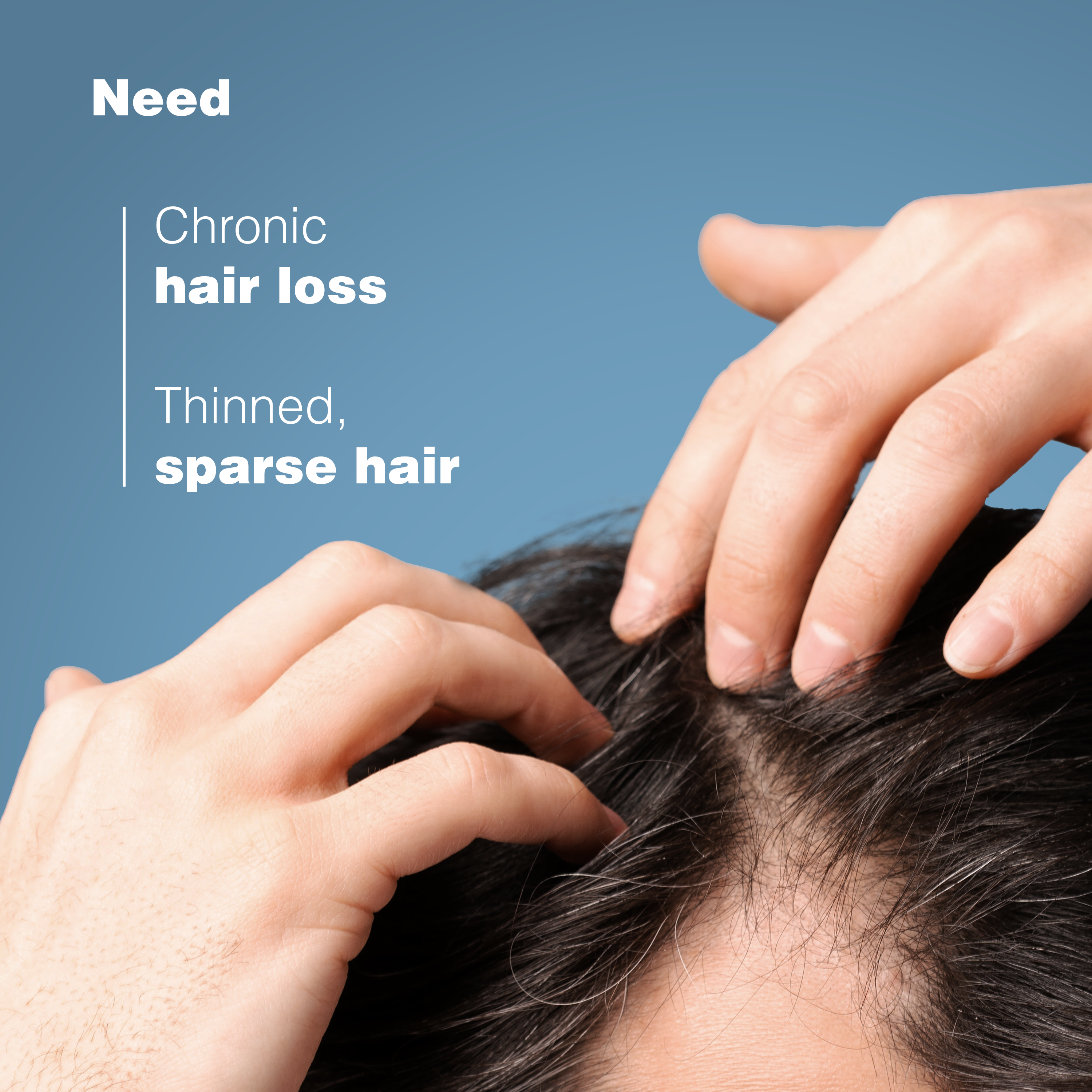 Anaphase Anti-Hair Loss Shampoo 400ML — image 7
