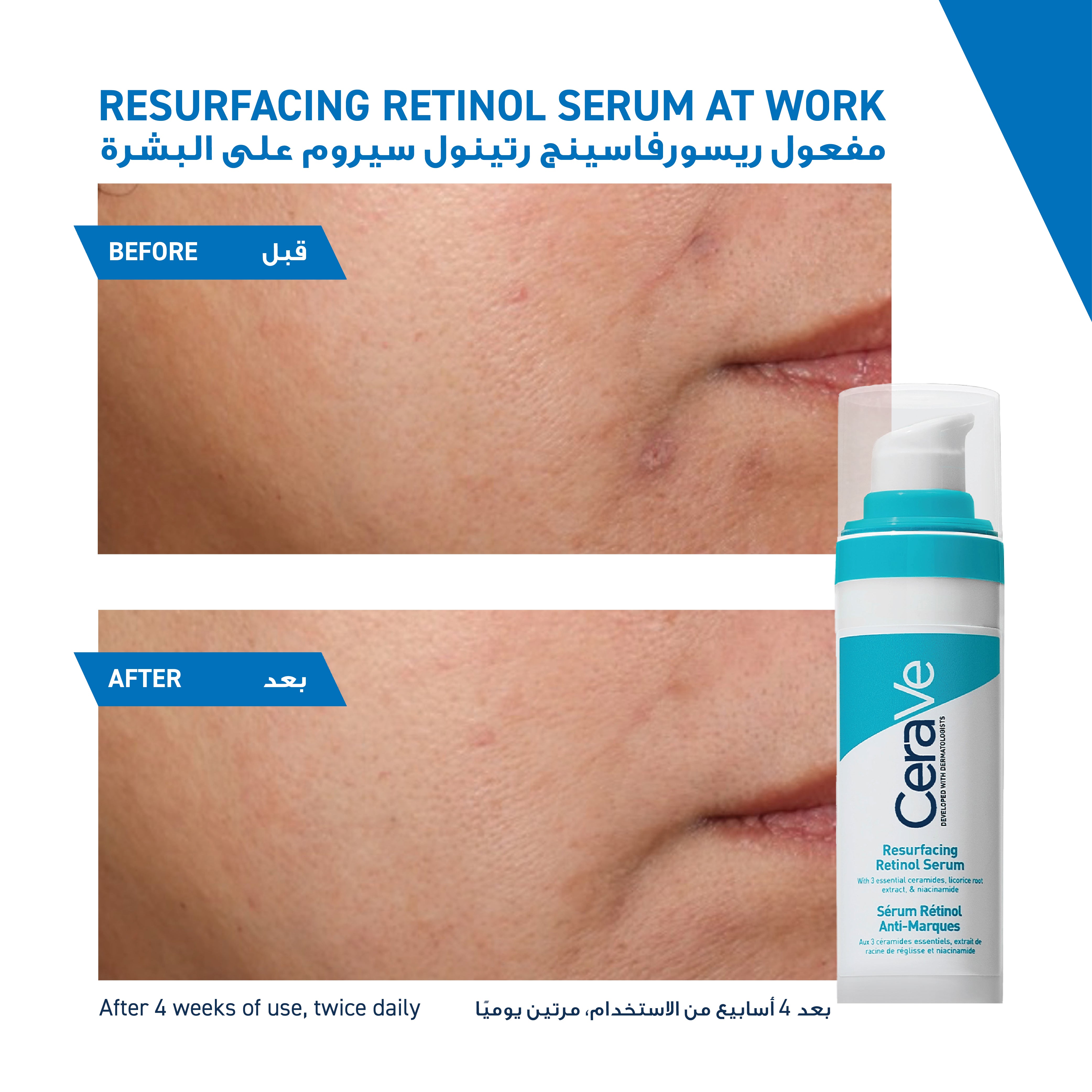 CERAVE RESURFACING RETINOL SERUM 30ml — image 9