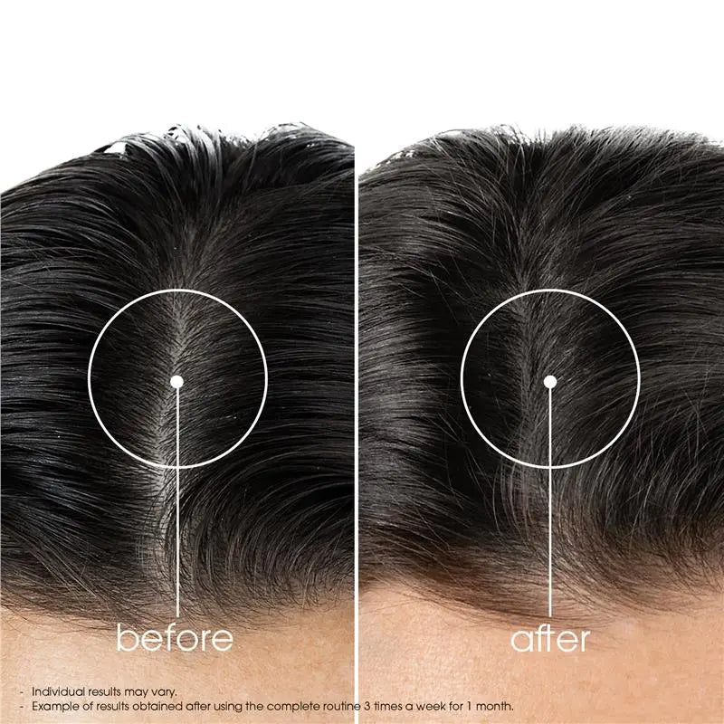 Klorane Anti-Hair Loss Strengthening & Stimulating Shampoo with Quinine 400ml — image 5